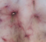 P. Matyszewski, Agorafobia, 2010